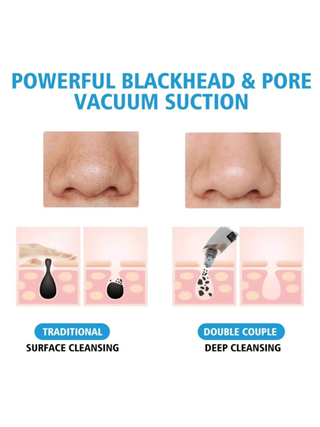 قطعة واحدة مكنسة للرؤوس السوداء للنساء ، منظف للمسام الوجهي، مكنسة شفط للرؤوس السوداء ب-5 مستويات شفط - مجموعة منظف الوجه بالطاقة الكهربائية المعتمدة على USB للكبار صانعة أدوات استخراج متعددة الوظائف للتنظيف