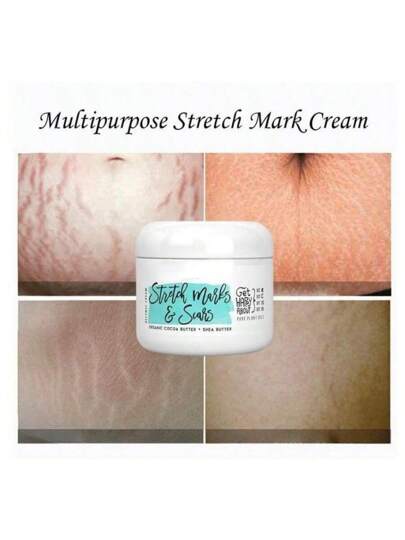كريم طبيعي عضوي لإزالة علامات التمدد بعد الولادة، لإصلاح البشرة، كريم ندبات الحمل للنساء