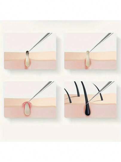 من 2 إلى 3 قطع أدوات إبرة تجميل لعلاج الشوائب والحبوب وإبرة الأكواع، مجموعة أداوات علاج الوجه لتنظيف البشرة، أساسيات السفر للعناية بالبشرة على الطراز الغوثي