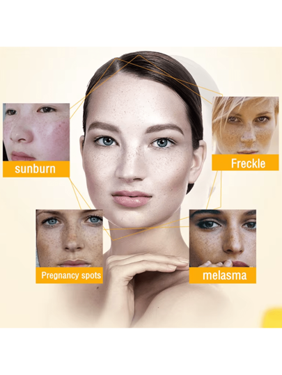 كريم وجه 50جم مرطب لإشراق وتفتيح البشرة الداكنة وعلاج النمش والندبات، يحتوي على حمض الهيالورونيك وجنسنج بنسبة 24 قيراط ذهب، وبيبتايد/نياسينامايد، كريم ترطيب ومحكم