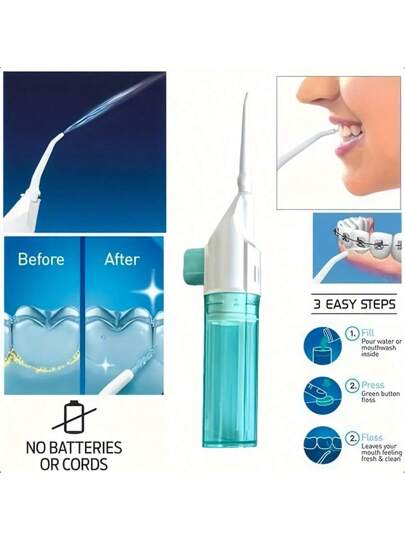 SOKANY جهاز غسيل الأسنان المحمول اليدوي عالي الضغط، جهاز غسل الأسنان، جهاز غسول الفم. صنع من مادة البولي بروبلين ذو تقنية نبضات عالية الضغط، تصميم بزر، فوهة قابلة للفك. مناسب جدًا لتنظيف الأسنان والعناية بالفم، بدون محرك كهربائي، مناسب للسفر...