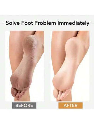 أدوات العناية بالقدمين حجر البوميس لإزالة الكالوس والبثور من القدمين، فرشاة قدم للتقشير والتنعيم، مبراة قدم كبيرة للعناية والتقشير