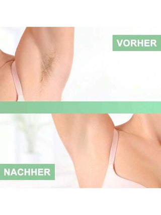 100 شريط شمع - أشرطة قماش غير منسوجة للشمع الدافئ وعجينة السكر - ازالة شعر آمنة على البشرة ومقاومة للتمزق لجميع مناطق الجسم كالساق والصدر والظهر والمناطق الحميمة والوجه