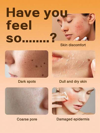 HEMEIEL لوشن فيتامين سي المنعش للبشرة الجافة وتضييق المسام - لوشن وجه ناعم للنساء والرجال - يخفف من الاحمرار والحكة الناتجة عن الجفاف