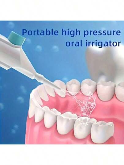 SOKANY جهاز تنظيف الأسنان اليدوي المحمول عالي الضغط ، جهاز غسل الأسنان ، جهاز شطف الفم. مصنوع من مادة ABS ، تقنية نبضات عالية الضغط ، تصميم زر ، فوهة قابلة للفك. مناسب جدًا لتنظيف الأسنان والعناية بالفم ، بدون محرك كهربائي ، مناسب للسفر العائلي....