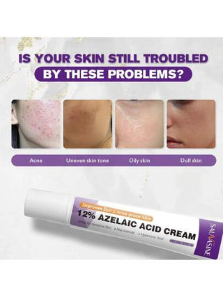 كريم حمض الأزيليك للوجه - كريم البشرة للروزاسيا لتقليل الحبوب والأكياس الدموية والتصبغات والاحمرار - جل حمض الأزيليك للعناية بالوجه والبشرة