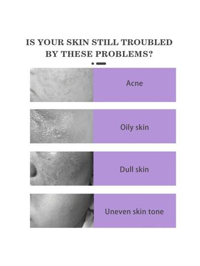 كريم حمض الأزيليك. ينظم عملية تقرن البشرة، ينظف المسام، ويقلل من تكون النمش. كما أنه يثبط نشاط الطيروزين، ويزيل آثار حب الشباب والنمش، ويُوحد لون البشرة، ويتحكم برفق في الزيوت، ويخلق بشرة ناعمة وشفافة.