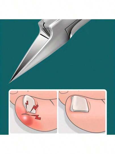 مقصات أظافر القدم من الفولاذ المقاوم للصدأ المحترف - غير حساسة للحساسية، مصنع للأظافر المتنامية والسميكة، أداة العناية بالقدمين بلا رائحة