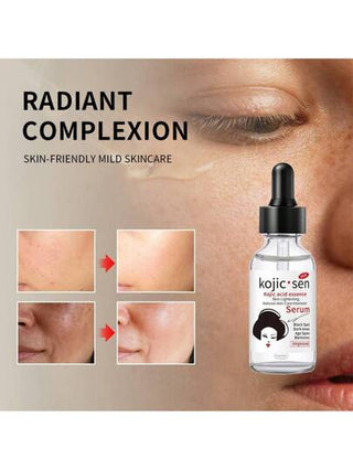 WWP زجاجة سيروم حمض الكوجيك 30 مل قطعة واحدة