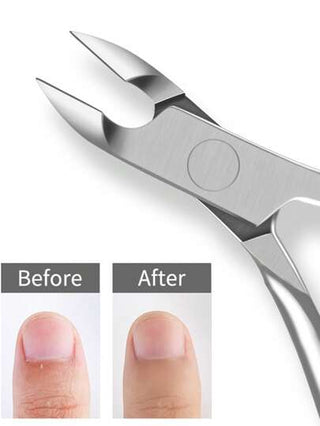 قاصة أظافر و معالجة البشرة قطعة واحدة، مقص للبشرة من الستانلس ستيل عالي الجودة أداة احترافية لعمليات المانكير والبديكير في المنزل/مركز التجميل/صالون