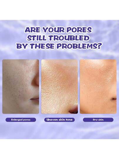 سيروم السيطرة على المسام عمل عميق للسيطرة على الزيت والدفاع عن الرؤوس السوداء - يحسن ملمس البشرة بشكل ملحوظ، يخفف اللمعان، يُنعِّم البشرة الخشنة، ويقلل الاحتقان