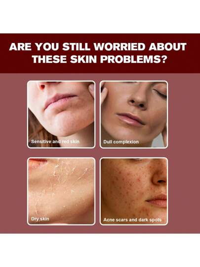 مصل به 10% نياسينامايد + 4% حمض ترانيكساميك مع السيراميد وحمض الهيالورونيك وفيتامين ب12- خالي من العطور، مناسب للبشرة الحساسة، يعزز جلد الزجاج، 30 مل