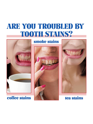 معجون أسنان 120 جرام مبيض مع بروبيوتيك، تنظيف فموي، يزيل الرائحة الكريهة والبقع، معجون أسنان مبيض وعناية باللثة