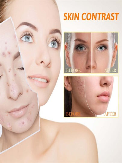 5مل/15مل/30مل/50مل/ سيروم العناية بالبشرة المضيء لوجه بالكركم والليمون لعلاج حب الشباب والبقع الداكنة والبقع السوداء والكلف ومزجليم الزيوت الأساسية المنيرة