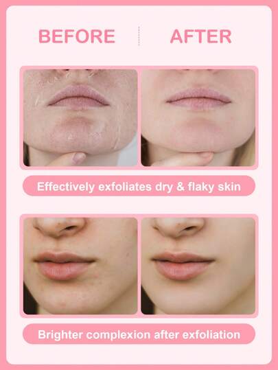 مقشر وجه SlowSunday Peach Face، خوخ، تقشير لمشاكل الوجه، العناية بالبشرة، ليوم الحب، هدية عيد الحب، هدية عيد الحب، لرمضان ومهرجان رمضان وهدايا