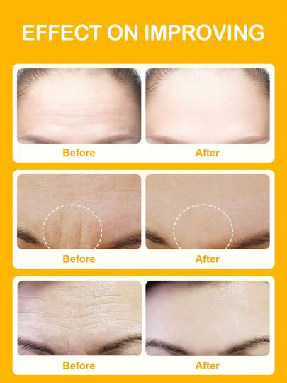 رقعة جبهة النياسين اميد SlowSunday 5 PCS، تحسين تجاعيد الجبهة، لخريف/الخريف، K Beauty، ليوم الحب، هدية عيد الحب، هدية عيد الحب، لرمضان ومهرجان رمضان وهدايا