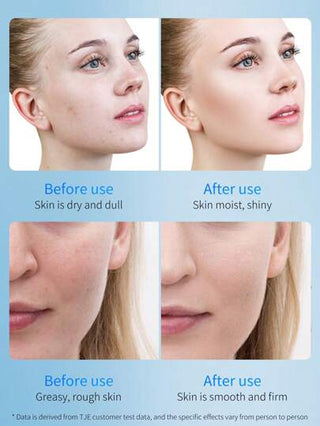 TJE سيروم TJE Peptide Ampoule بحجم 1.5 مل * 28 قطعة ، سائل اساس ضد حب الشباب والتجاعيد ، منشط ومرطب ، يقلل آثار حب الشباب ، يصلح الجلد التالف
