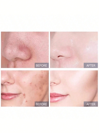 CeraVe منظف وجه بحمض السالسيليك، مرطب ومعيد لبناء الحواجز