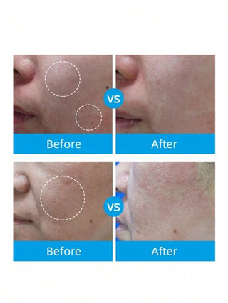 La Roche-Posay كريم إصلاح مهدئ B5 جديد 40مل، مرطب، إصلاح أضرار ما بعد التعرض للشمس، إخفاء العلامات، احمرار
