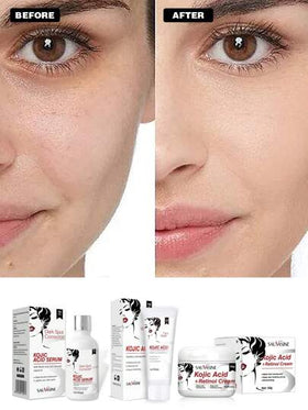 LANTHOME مجموعة عناية بالبشرة من حمض الكوجيك 3قطع - غسول وجه حمض الكوجيك 100مل + كريم ترطيب حمض الكوجيك 50جرام + سيروم حمض الكوجيك 30مل، يفتح لون البشرة، يرطبها، يصلح الشحوب