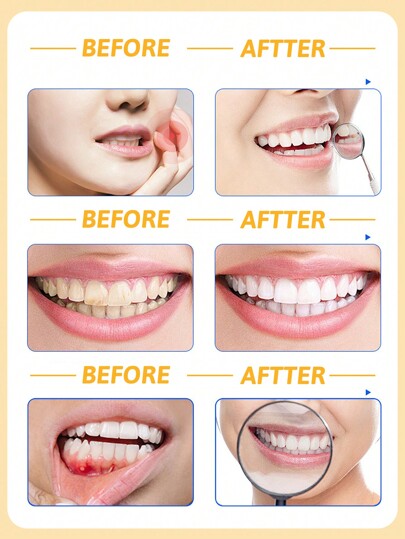 colgate معجون أسنان منعش للثة بزاوية 360 درجة، منعش للأنفاس، يغذي اللثة، مستخلص البابونج، يقلل من التهاب الفم، إزالة البقع، 1 قطعة (120 جم / 4.23 أونصة)
