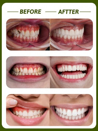colgate 4 قطع، معجون أسنان علاجي لتغذية اللثة، صيغة عشبية تقليدية، منعش للأنفاس، يقلل من التهاب الفم، علاج اللثة، برائحة البرتقال (360جم/12.68 أونصة)