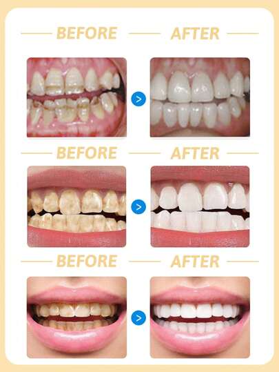 colgate معجون أسنان تنظيف رعاية اللثة 360 درجة، يقوي اللثة، ينعش النفس، بجوهر الفحم الخيزران، يقلل من التهاب الفم، يقلل من الرواسب الجير، قطعة واحدة (120جم/4.23 أونصة)