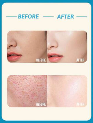 Olay ماء التغذية المرطب المنشط ريجونيريست، ترطيب طويل الأمد، تغذية البشرة، ترطيب ، يحسن من لون البشرة غير المتساوي، مستخلص الخيار، جوهر الصبار، ملمس منعش، تنشيط البشرة، مناسب لجميع أنواع البشرة وخاصة لاحتياجات الترطيب والتنشيط، مناسب للعناية اليومية...