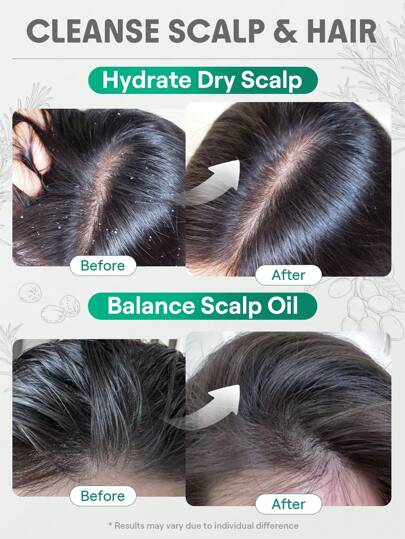 SHEGLAM HAIR زيت إكليل الجبل للشعر وفروة الرأس -15 مل/0.5 أونصة سائلة، زيت أساسي للعناية بالشعر، مصل زيت إكليل الجبل المرطب، توازن دهون فروة الرأس، تهدئة فروة الرأس الجافة، زيادة اللمعان والمرونة، تغذية بصيلات الشعر، غني بزيت إكليل الجبل، زيت بذور...