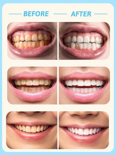 colgate معجون أسنان البيكربونات المبيض برائحة الياسمين - عبوة 3 حبات، مبيض للأسنان، لطيف وغير كاشط، رغوة غنية، منعش للأنفاس، عالي النقاء