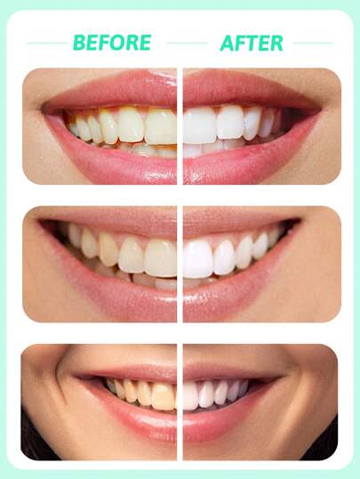 colgate معجون أسنان صودا الخبز المبيّض بنكهة النعناع - 3 قطع، مُبيّض، لطيف وغير كاشط، كثير الرغوة، منعش للأنفاس، عالي النقاء