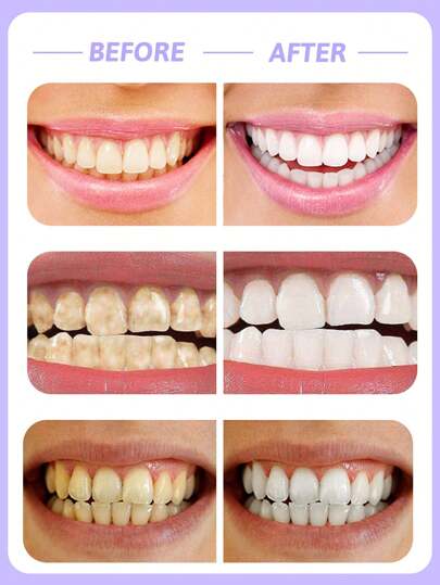 colgate معجون أسنان باستخدام بيكربونات الصوديوم المبيضة بنكهة النعناع الشمالية الأمريكية، مبيض - 3 قطع، لطيف وغير كاشط، رغوة غنية، منعش للأنفاس، عالي النقاء