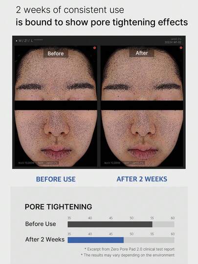 وسادات تنظيف الجوانب Medicube ZERO PORE PAD 2.0، مسام غير مرئية، تجديد سريع للبشرة في 60 ثانية، مناسبة للبشرة الحساسة، حجم السفر، منقع مسبق التشريب، تنعيم نسيج البشرة، تنظيف بعد التمرين، إصلاح ليلي | مستحضرات تجميل كورية | 155 جرام/5.46 أونصة
