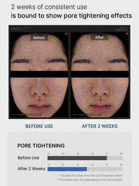 وسادات تنظيف الجوانب Medicube ZERO PORE PAD 2.0، مسام غير مرئية، تجديد سريع للبشرة في 60 ثانية، مناسبة للبشرة الحساسة، حجم السفر، منقع مسبق التشريب، تنعيم نسيج البشرة، تنظيف بعد التمرين، إصلاح ليلي | مستحضرات تجميل كورية | 155 جرام/5.46 أونصة