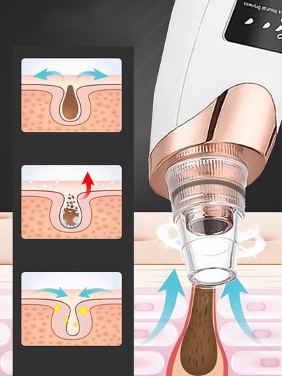 مزيل الرؤوس السوداء، جهاز تنظيف المسام، جهاز تجميل الوجه، أداة إزالة الرؤوس البيضاء لحب الشباب، أداة العناية بالوجه والبشرة