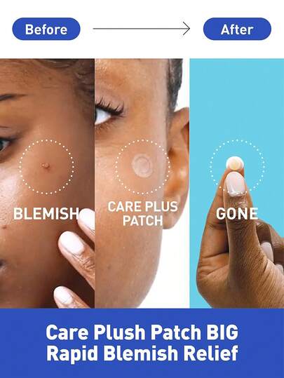 Olive Young بقع زرقاء للعناية، 102 قطعة، مناسبة للاستخدام اليومي