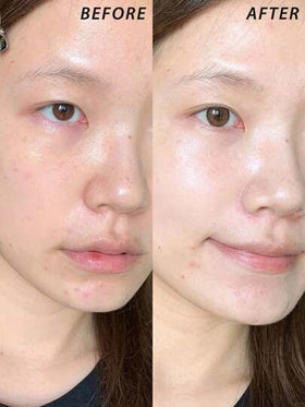 Lancôme لانكوم [ميني] إيدول مصحح لون البشرة بالتلوين #01 يخفف من الخمول 10مل / أساس تحضيري للمكياج يضمن تطبيق مكياج ناعم وطويل الأمد وطبيعي المظهر / يعدل لون البشرة: حقق مظهر بشرة موحد وطبيعي / يحسن ملمس البشرة: يظهر مظهر صحي وبراق بشكل طبيعي / يكمل أس...