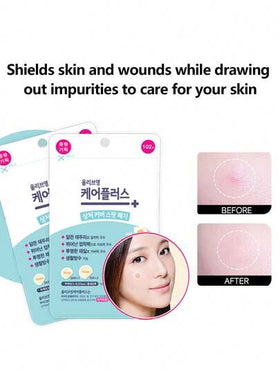 Olive Young 1 قطعة من بقع علاج الحبوب من Care Plus، بقع حبوب غير مرئية، بقع حبوب هيدروكولويد، صيغة كورية، تغطي بفعالية الحبوب والبثور والعيوب، مناسبة للبشرة والوجه المشكلة، مقاومة للماء والعرق، تغطي أيضًا ندبات الحبوب، بقع الحبوب الطارئة