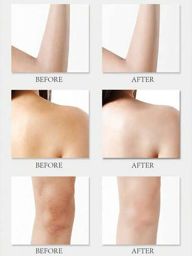 L'Occitane 2 * 35مل جل استحمام + 2 * 10مل كريم يد بزهر الكرز