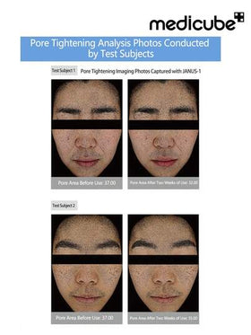 Medicube وسادات المسام الصفرية 2.0 (70 وسادة)، وسادات حمض السالسيليك لتقليل المسام والعناية بالمسام مع 4.5% من حمض اللاكتيك AHA و 0.45% من حمض السالسيليك BHA، مثالية لجميع أنواع البشرة، العناية الكورية بالبشرة