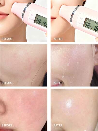 La Roche-Posay بلسم إصلاحي لاروش بوزيه سيكابلاست بوم ب5+ 40مل - 1.35 أونصة سائلة