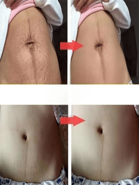 زيت العناية المرطب للجسم بأكمله: انطلق في رحلة ترطيب وتغذية البشرة