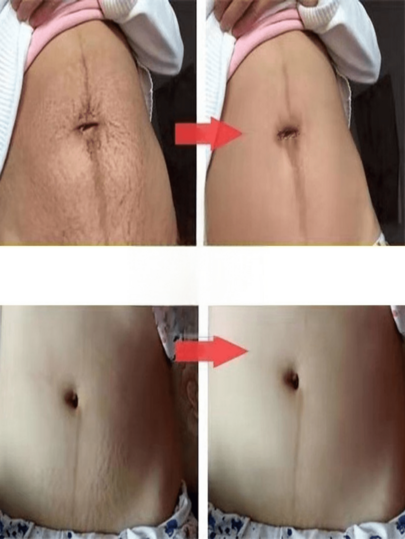 زيت العناية المرطب للجسم بأكمله: انطلق في رحلة ترطيب وتغذية البشرة