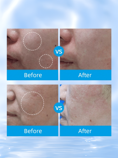 La Roche-Posay بلسم لاروش بوزيه سيكابلاست بي 5 متعدد الأغراض 40 مل، يهدئ الاحمرار ويعيد بناء حاجز البشرة، مناسب لأضرار البشرة الموسمية