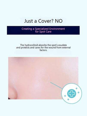 Olive Young صندوقان من بقع علاج حب الشباب Care Plus، 102 قطعة، ملصقات للوجه، العناية الكورية بالبشرة، مستحضرات التجميل الكورية