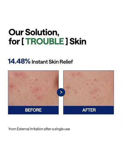 Mediheal سيروم هيدرا المهدئ بشجرة الشاي 40مل، صيغة خفيفة غير لزجة، مستخلص شجرة الشاي بتركيز 19,900 جزء في المليون للتهدئة الفورية، حمض الهيالورونيك بتركيز 2,800 جزء في المليون للترطيب العميق، مناسب للبشرة الحساسة والدهنية.