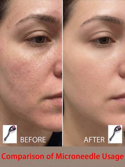 طقم تجميل الوجه واللحية بالإبر الدقيقة، يشمل أدوات تجميل الشعر والبشرة وامتصاص الزيوت للرجال والنساء، لوازم الحلاقة، مشابك الشعر، العناية بالبشرة، العناية الذاتية، الحمام، العودة إلى المدرسة، الضروريات السفرية، لوازم التنظيف
