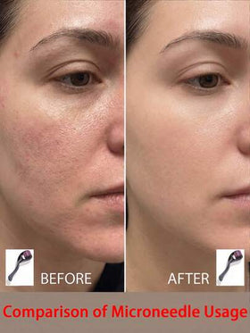 طقم تجميل الوجه واللحية بالإبر الدقيقة، يشمل أدوات تجميل الشعر والبشرة وامتصاص الزيوت للرجال والنساء، لوازم الحلاقة، مشابك الشعر، العناية بالبشرة، العناية الذاتية، الحمام، العودة إلى المدرسة، الضروريات السفرية، لوازم التنظيف