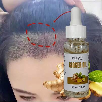زيت زنجبيل أساسي MELAO، يحتوي على مستخلص زنجبيل طبيعي خالص، يغذي فروة الرأس ويضيف لمعان وليونة وقوة للشعر، 30 مل / 1.01 أونصة سائلة، مع قطارة