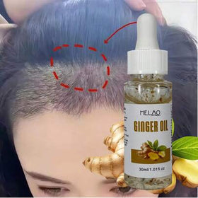 زيت زنجبيل أساسي MELAO، يحتوي على مستخلص زنجبيل طبيعي خالص، يغذي فروة الرأس ويضيف لمعان وليونة وقوة للشعر، 30 مل / 1.01 أونصة سائلة، مع قطارة